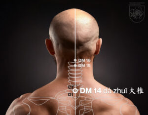 DM 14 (dà zhuī 大椎)